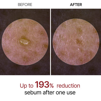 💆‍♀️ Experience Ultimate Luxury - ✨ Peel Shot Glow Rice Ampoule Duo - Serums for Brightening, Exfoliating, and Moisturizing🌾
