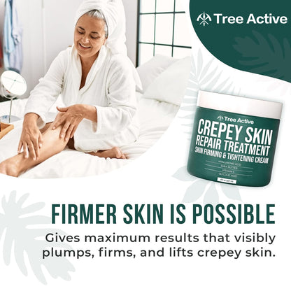 TreeActive Crepey Skin Repair Treatment, 8oz, Firming Cream with Hyaluronic Acid & Shea Butter to Deeply Moisturize & Tighten Wrinkly Dry Crepe Skin, 500+ Uses