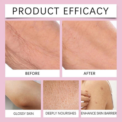🎊 Experience Ultimate Luxury - 50% OFF - ✨ Champagne Beaute Lift Firming Body Crème - For Firmer, Smoother, Radiant Skin! 🌟（Buy 3 & Free Shipping）
